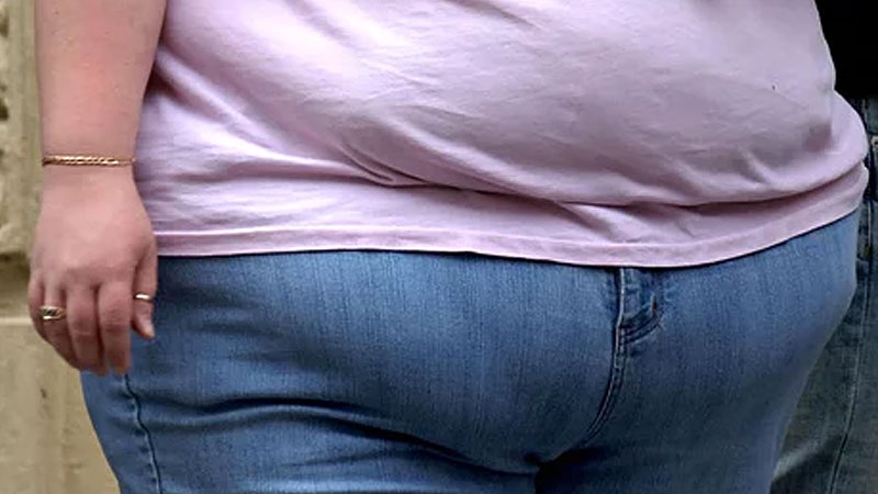 Ученые связали ожирение у детей с риском раннего инсульта