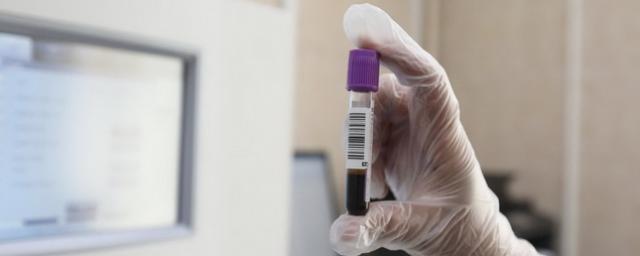 Роспотребнадзор: В РФ не выявили случаев гепатита неизвестного происхождения
