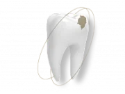 Эстетическая стоматология: принципы, методы и уход за улыбкой